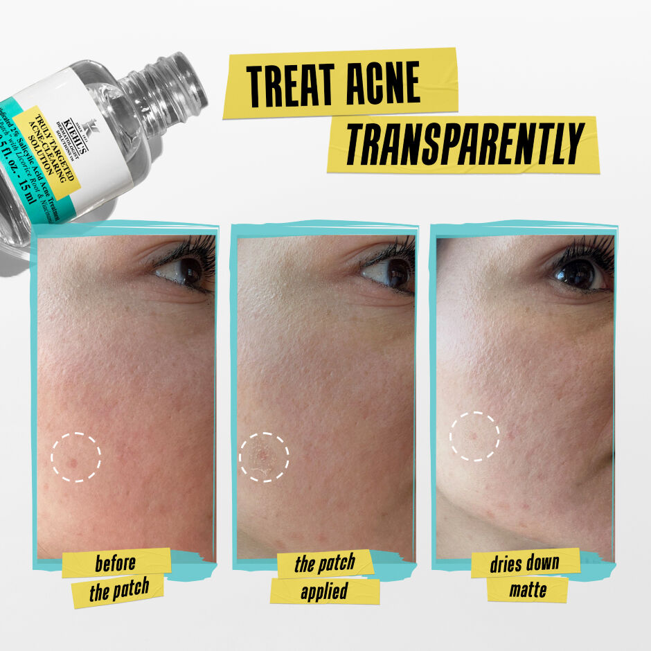KIEHLS Truly Targeted Acne Clearing Solution 07