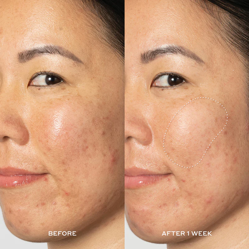 OLEHENRIKSEN Glow2OH Dark Spot Toner 03