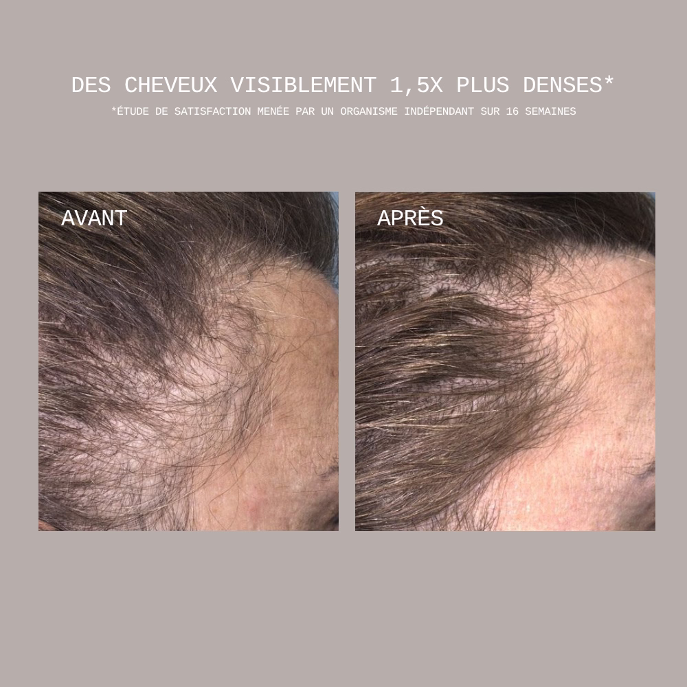 CECRED Restoring Hair Edge Drops 05