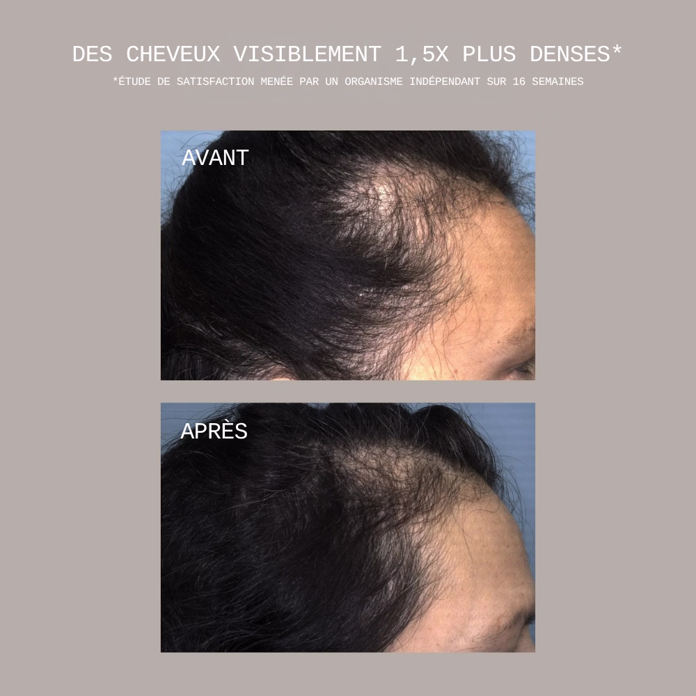 CECRED Restoring Hair Edge Drops 08